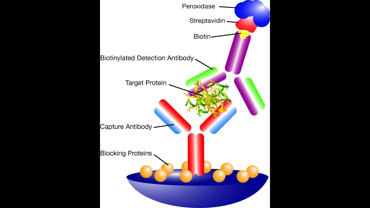 ELISA types(,,direct ,indirect  &sandwich )and  Radioimmunoassay