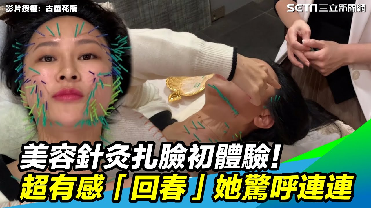 美容針灸扎臉初體驗！　超有感「回春」她驚呼連連｜三立新聞網 SETN.com