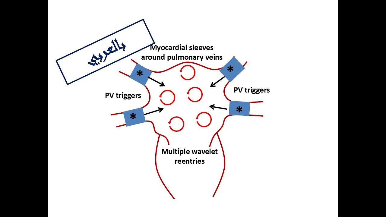ESC Guidelines of AF: 1. Definitions & Clinical Impact of AF (Arabic Version)