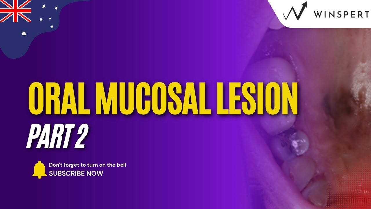 Oral Mucosal Lesions (2nd Part) TG 4