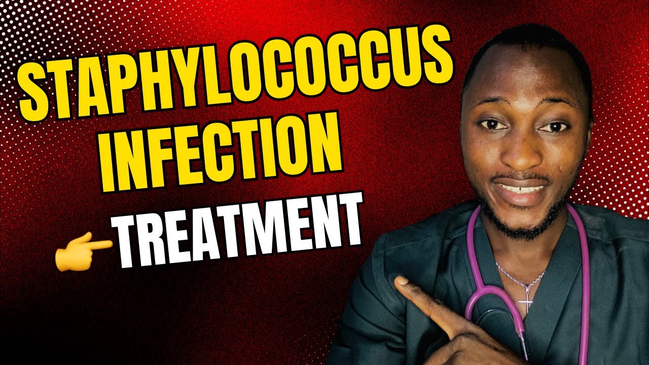 How to treat staphylococcus infection (How to treat staphylococcus Aureus)