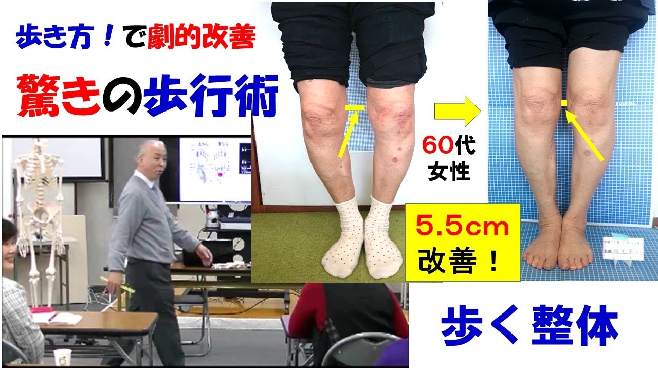 歩き方でO脚が改善する驚きの歩行術