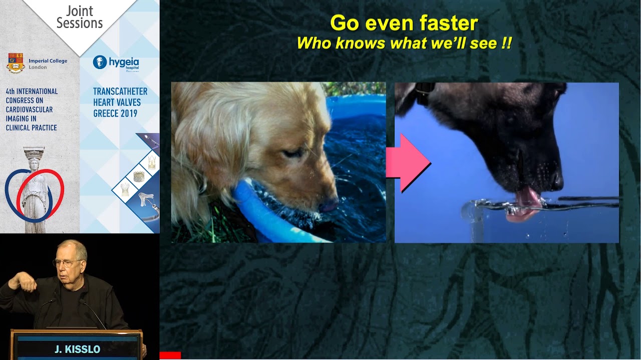 J. Kisslo | Three-Dimensional Echocardiography is key.