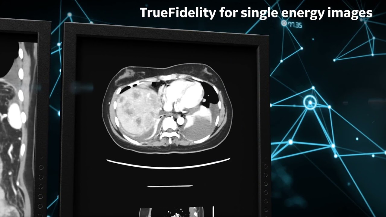 What's New with CT at GE Healthcare?