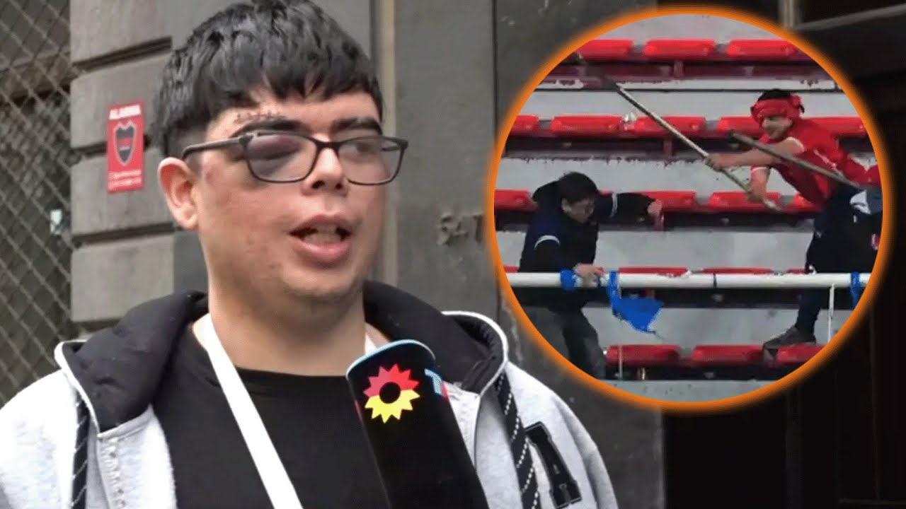 Diego, hincha de la U de Chile, terminó fracturado y apuñalado en la cancha de Independiente