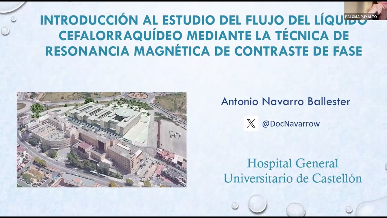 881. Introducción al estudio del flujo del líquido cefalorraquídeo