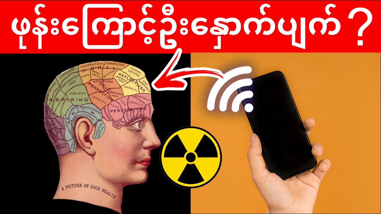 ဖုန်းကို ခေါင်းအုံးဘေးမှာချအိပ်ရင် ဦးနှောက်ထိနိုင်လား ? ကင်ဆာ?