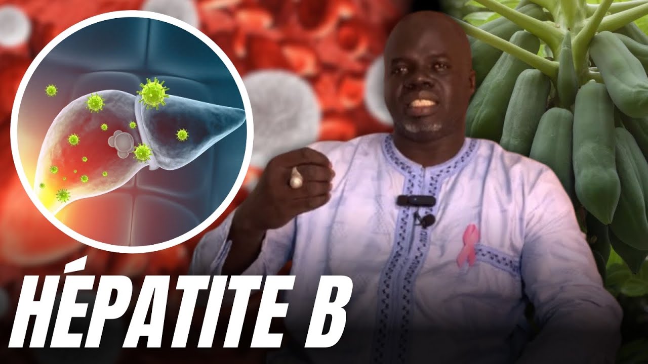 Hépatite B #2- ( Préventions et Solutions ) - Pr Ousmane Ndiaye - SAMA XALAAT TV