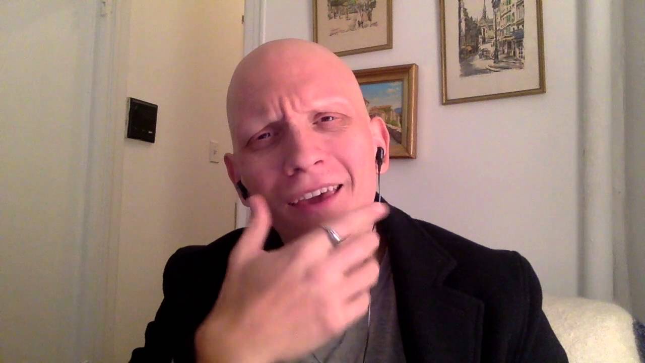 Anthony Carrigan Alopecia Bullying Awareness