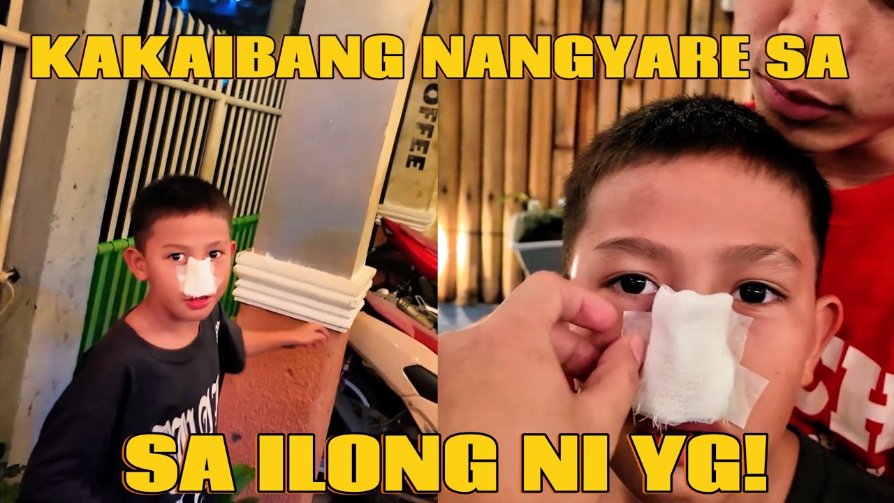 Kakaibang Nangyare sa ILONG ni YG! 