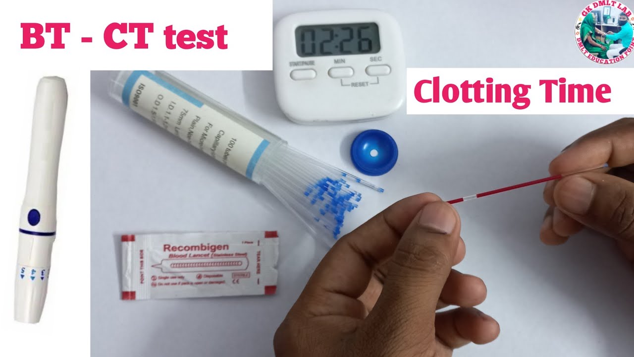 BT CT Test | blood clotting time determination by Using Capillary mathod (ब्लड क्लॉटिंग टाइम)#blood