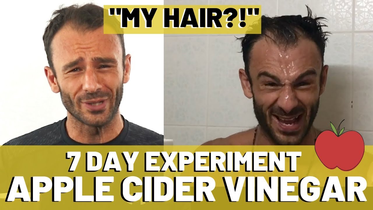 Apple Cider Vinegar Results For Hair Loss (7 DAYS!)