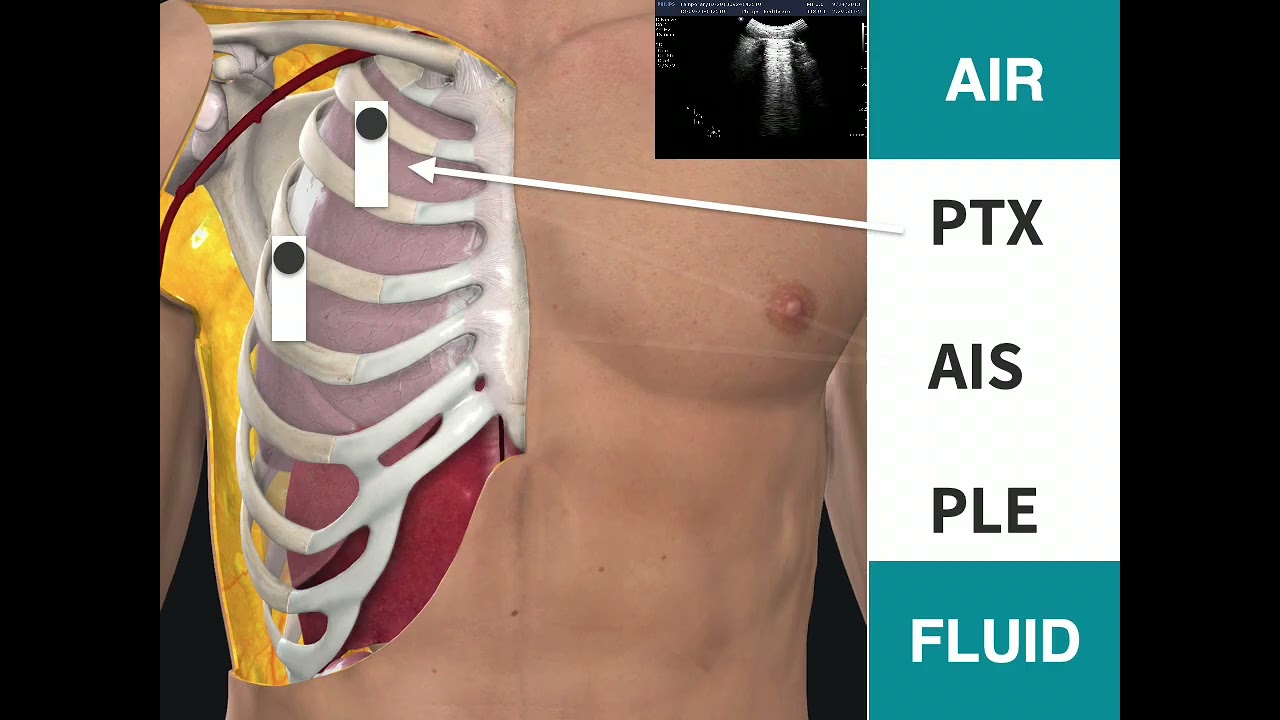 20251107 Lung & Diaphragm Part 1