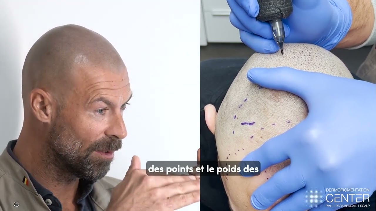 Micropigmentation capillaire rase versus poudre de Kératine