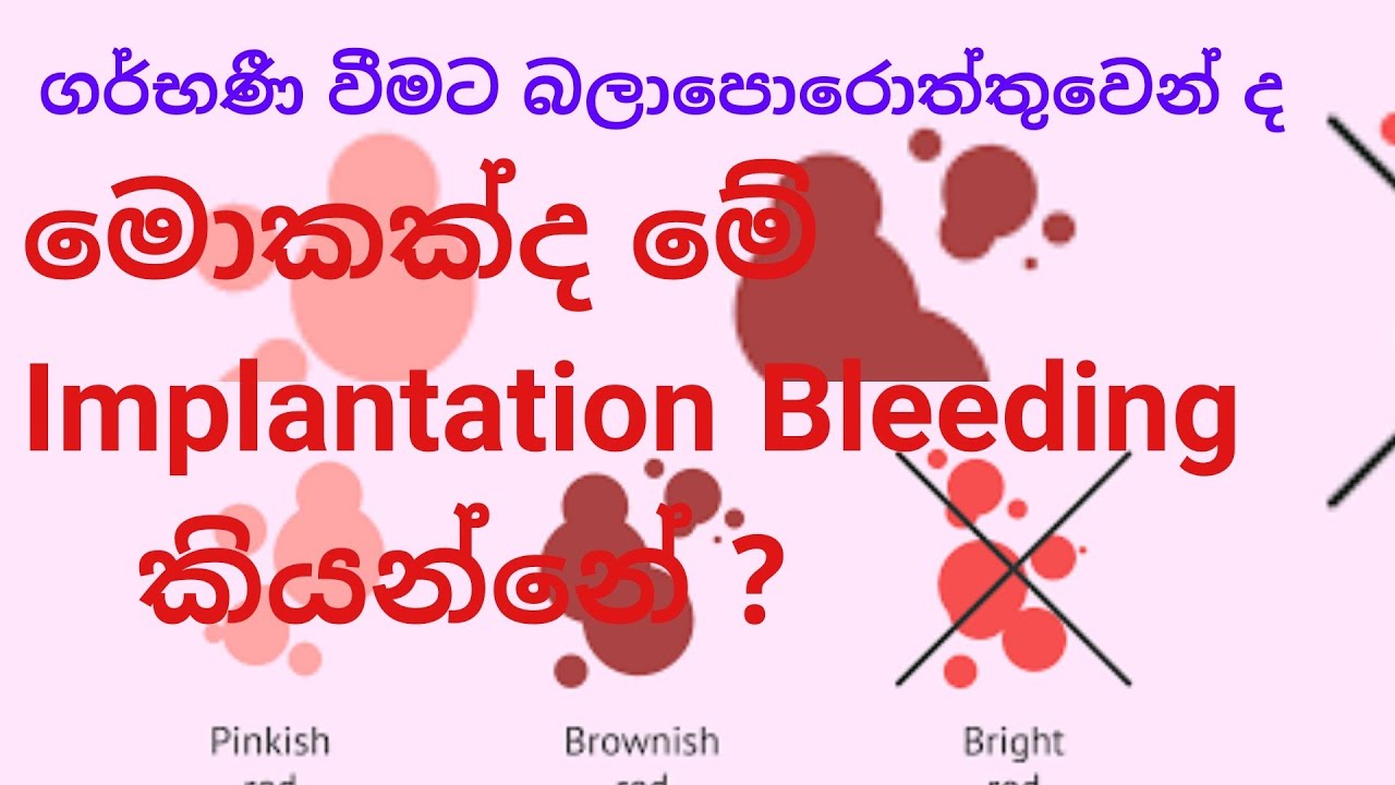 Implantation Bleeding ද Period ද කියලා නිවැරදිව දැනගන්න ආකාරය | Implantation Bleeding | Sinhala.