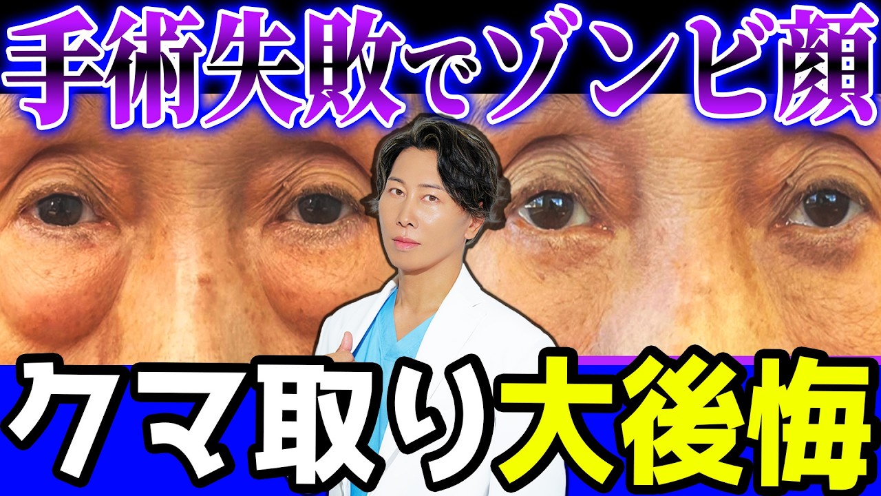 【一生後悔】安易にクマ取り手術をした結果治らないゾンビ顔になってしまう理由と原因は...？【クマ取り】【美容医療】【若返り】