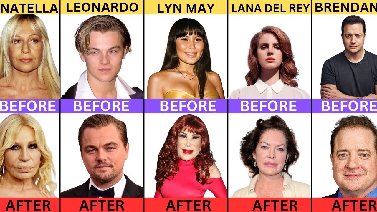 Shocking Celebrity Transformations  They Changed Completely || 2025