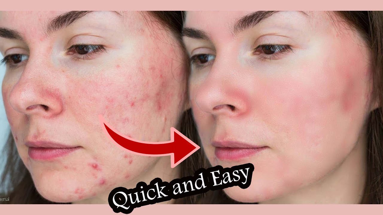 How to Face Retouching Best Photoshop Tutorial I How to Skin Retouching 2025 মুখের দাগ মুছার পদ্ধতি
