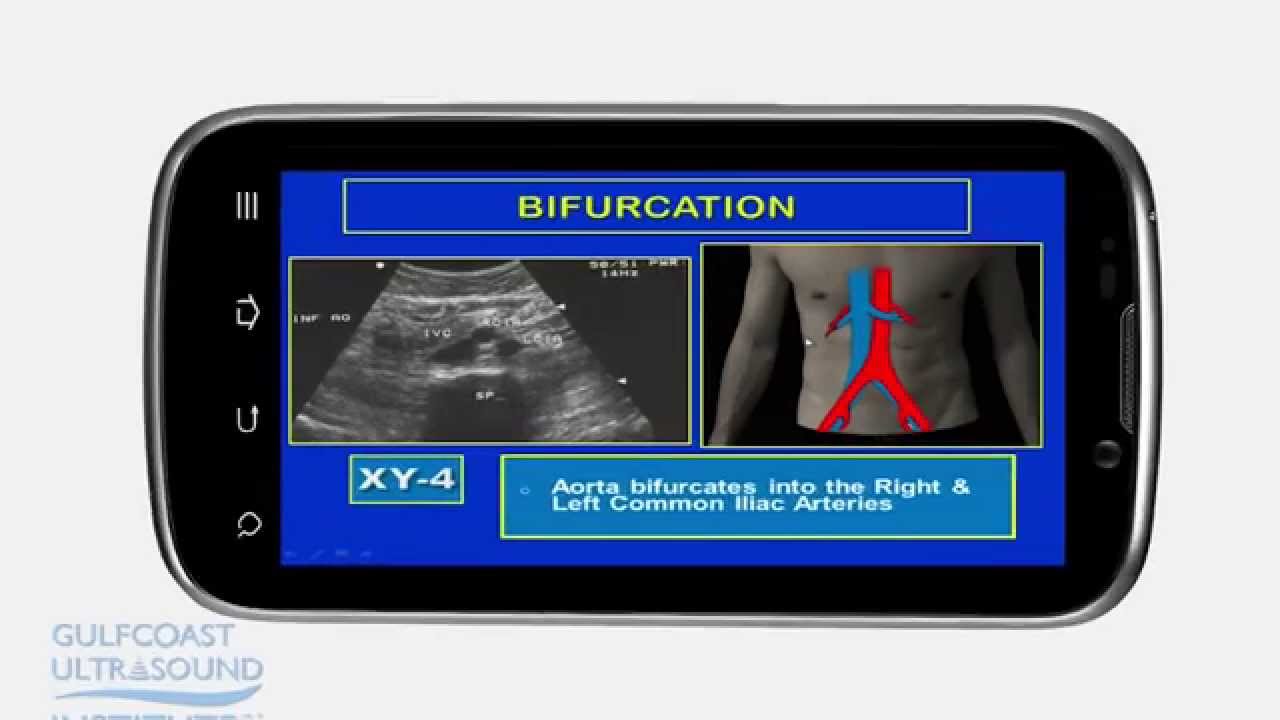 Gulfcoast Ultrasound Institute's Online videos - Watch for 30 days or Unlimited views