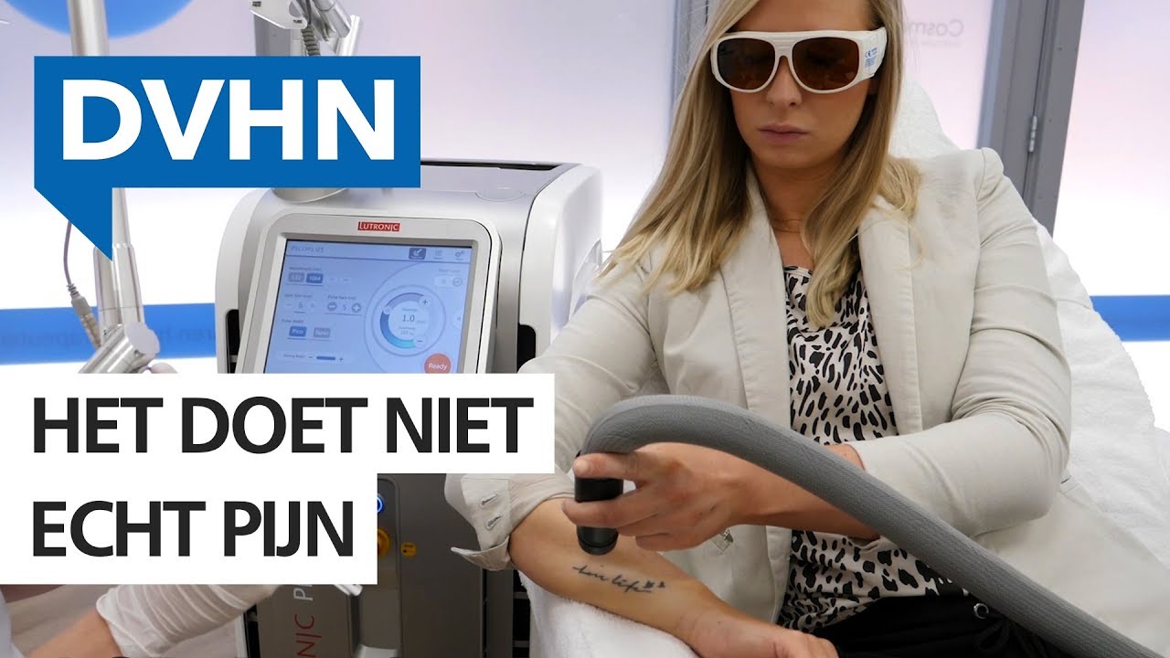 Schaamte over de tatoeage van je ex? Zo snel ben je er van af