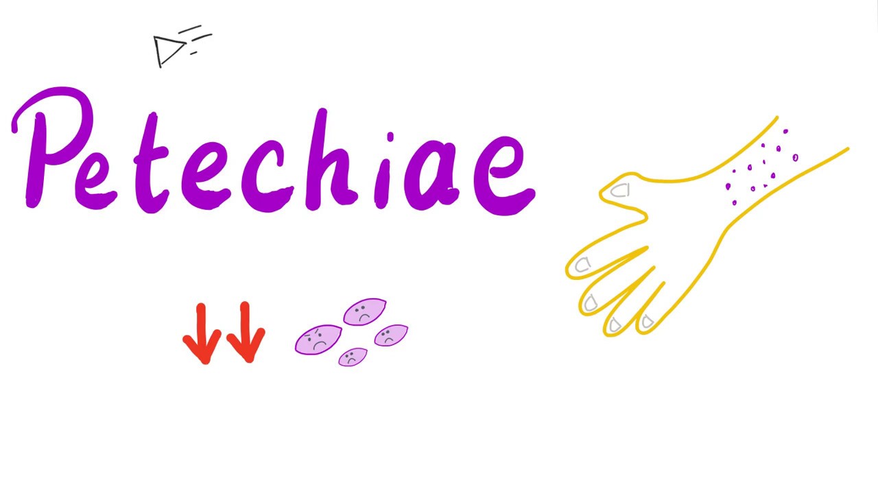 Petechiae | Subcutaneous Hematoma | Forensic Medicine