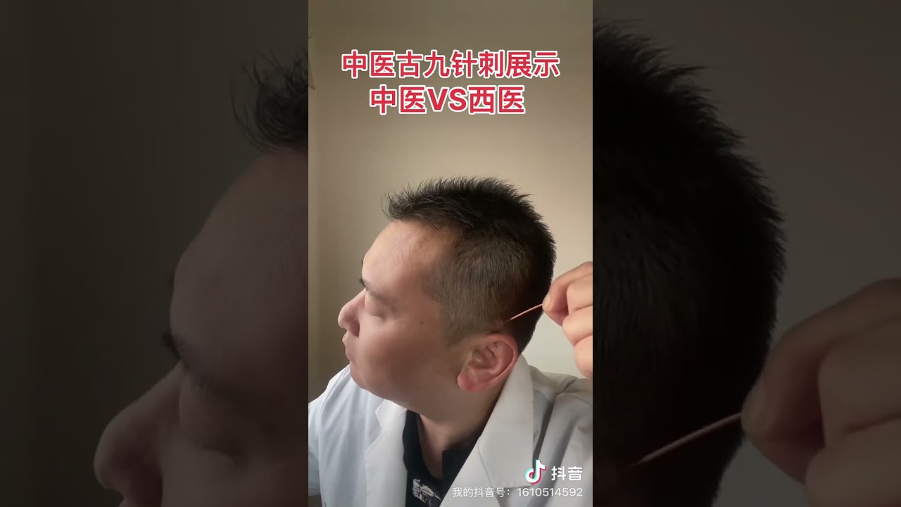 #Acupuncture in Traditional Chinese Medicine#Acupuncture video#TCM#Meridian and acupoint#T