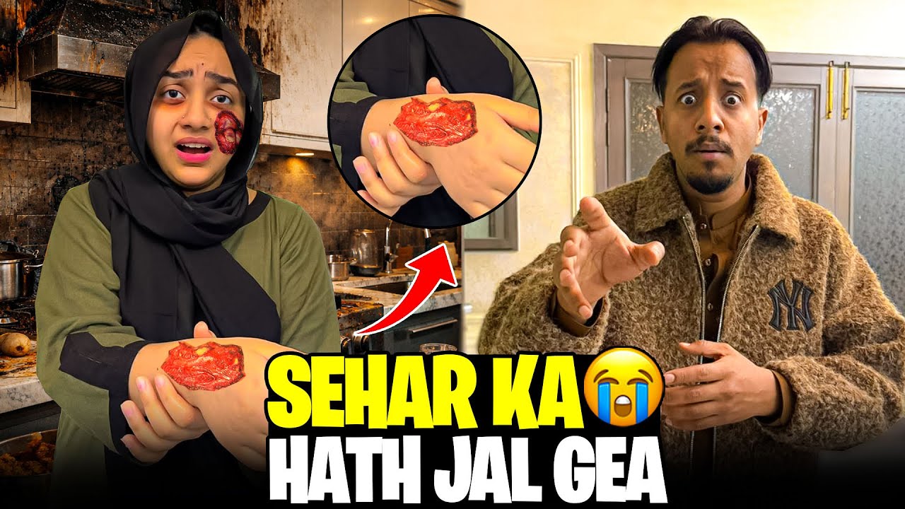 SEHAR KA Hath Jaal Geya💔😱|Tension Sy Bura Haal Hoagaya😭|Sheikh Vlogs