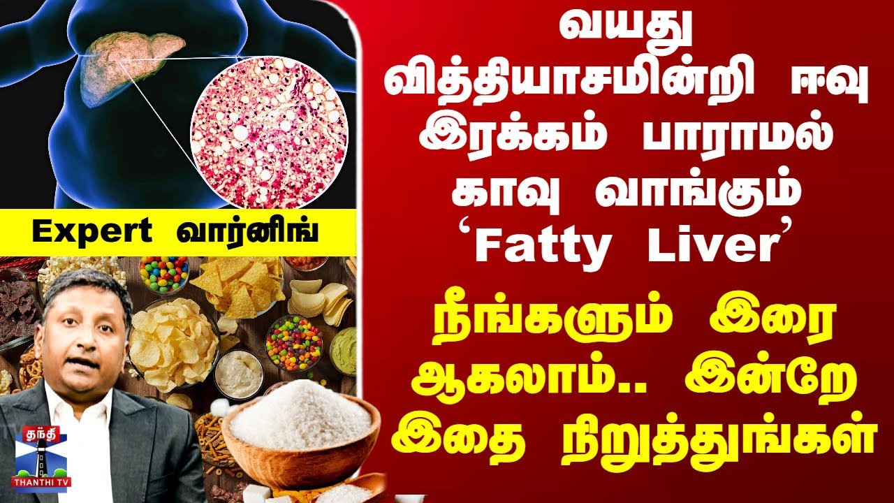Fatty Liver Avoid Foods | வயது வித்தியாசமின்றி காவு வாங்கும் `Fatty Liver’ - Expert வார்னிங்
