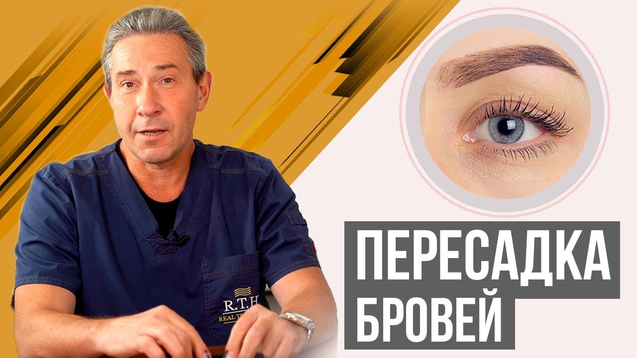 Пересадка бровей. Собственные густые брови навсегда. До и после.