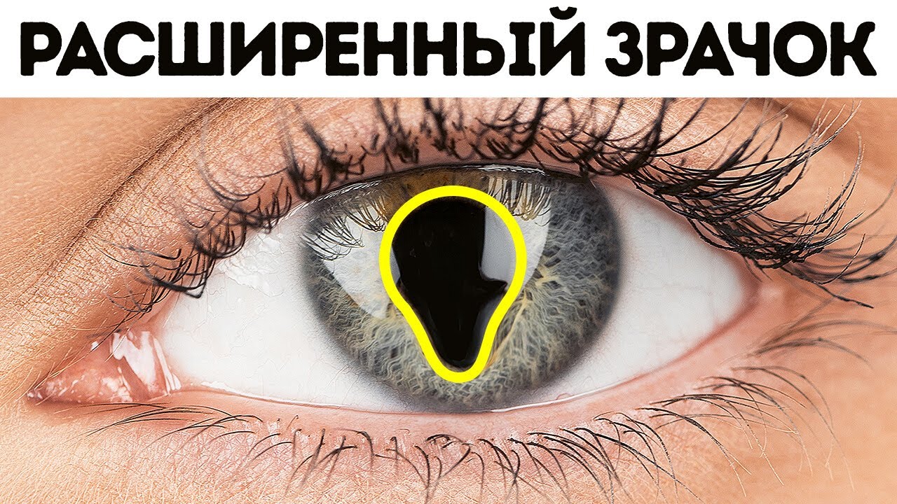 30+ редких особенностей тела, которые могут быть или не быть у вас