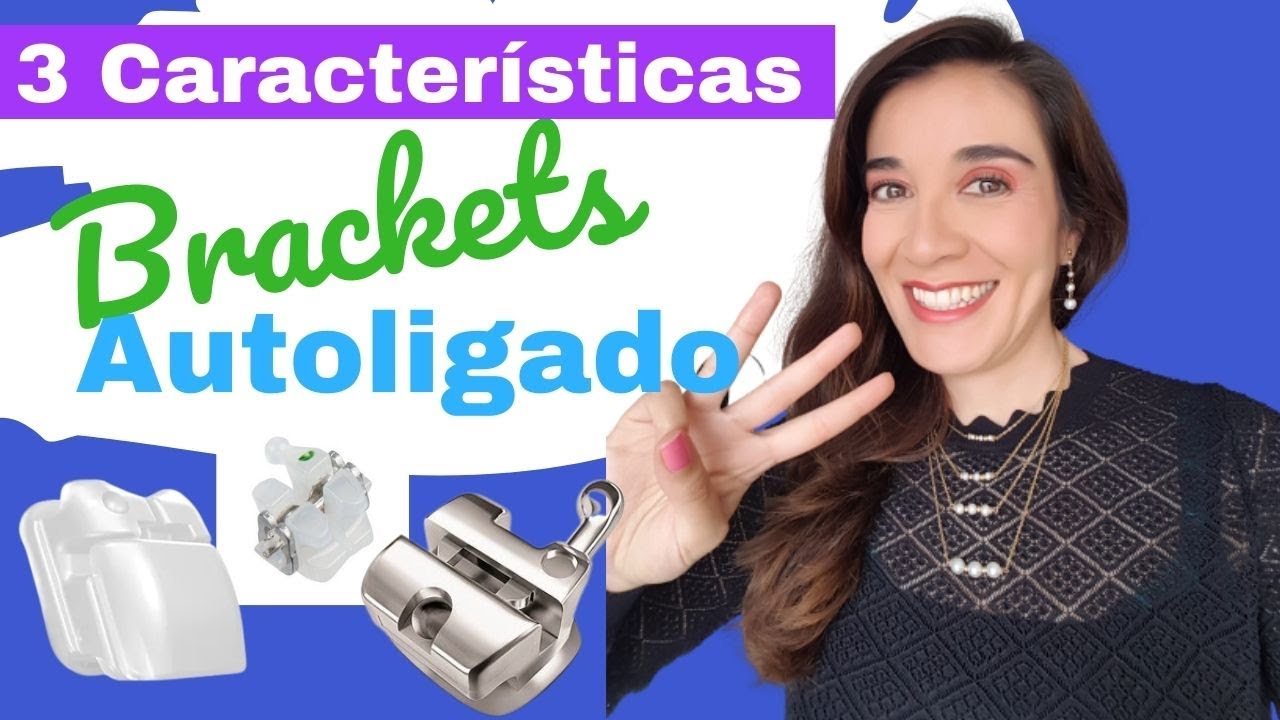 3 Características de los brackets AUTOLIGADO
