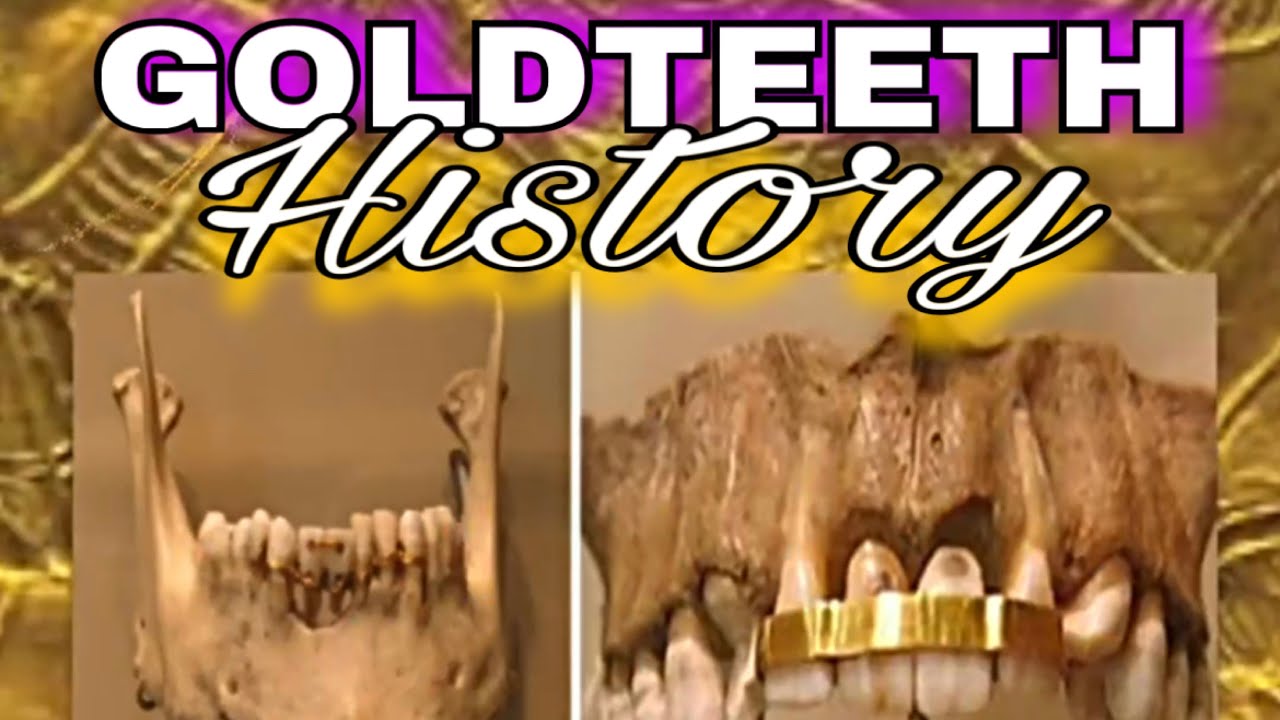 History of Goldteeth and big cuban links
