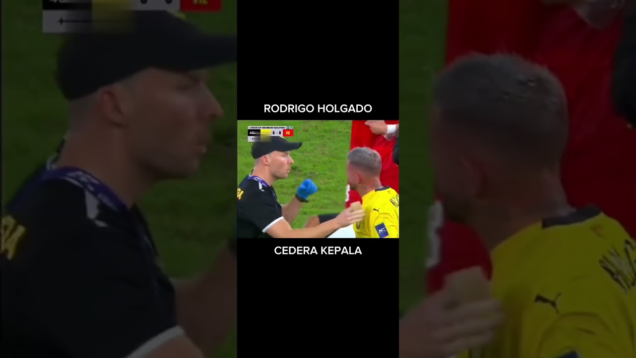 Rodrigo Holgado Cedera Kepala