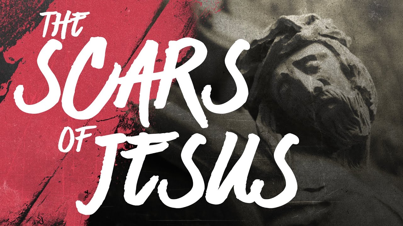 Did All of Jesus's Crucifixion Scars Transfer to His Post-Resurrection Body?