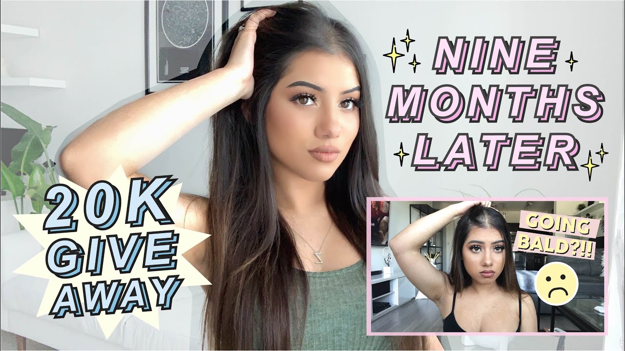 MY HAIR IS GROWING BACK + 20K GIVEAWAY | Zoe Cavey
