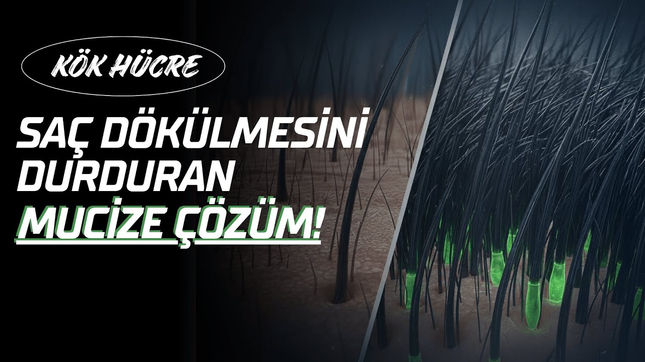 Kök Hücre Nedir? Dökülen Saçlar Geri Çıkar mı? 🧐  #KÖKHÜCRE