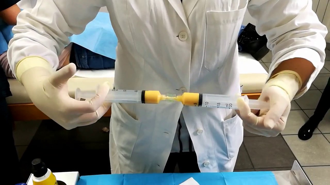 NanoFat Transfer by Tulip