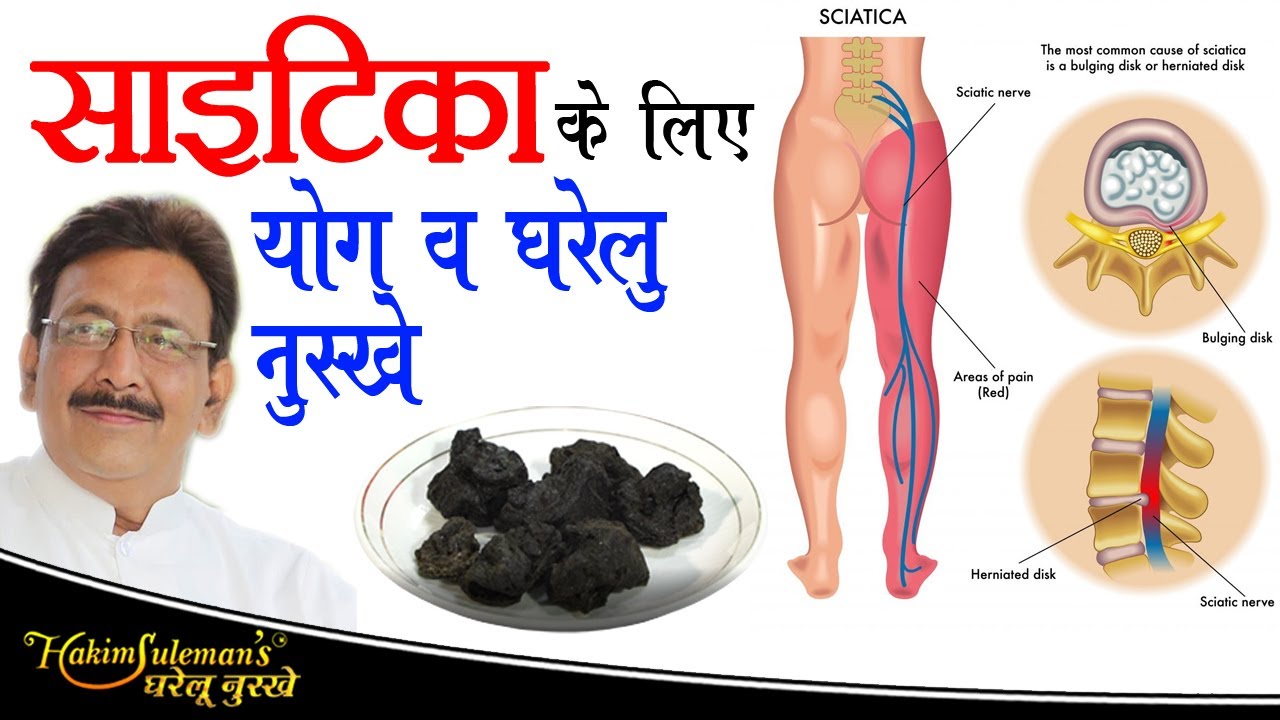 साइटिका के दर्द में आराम देगा यह घरेलु उपाय