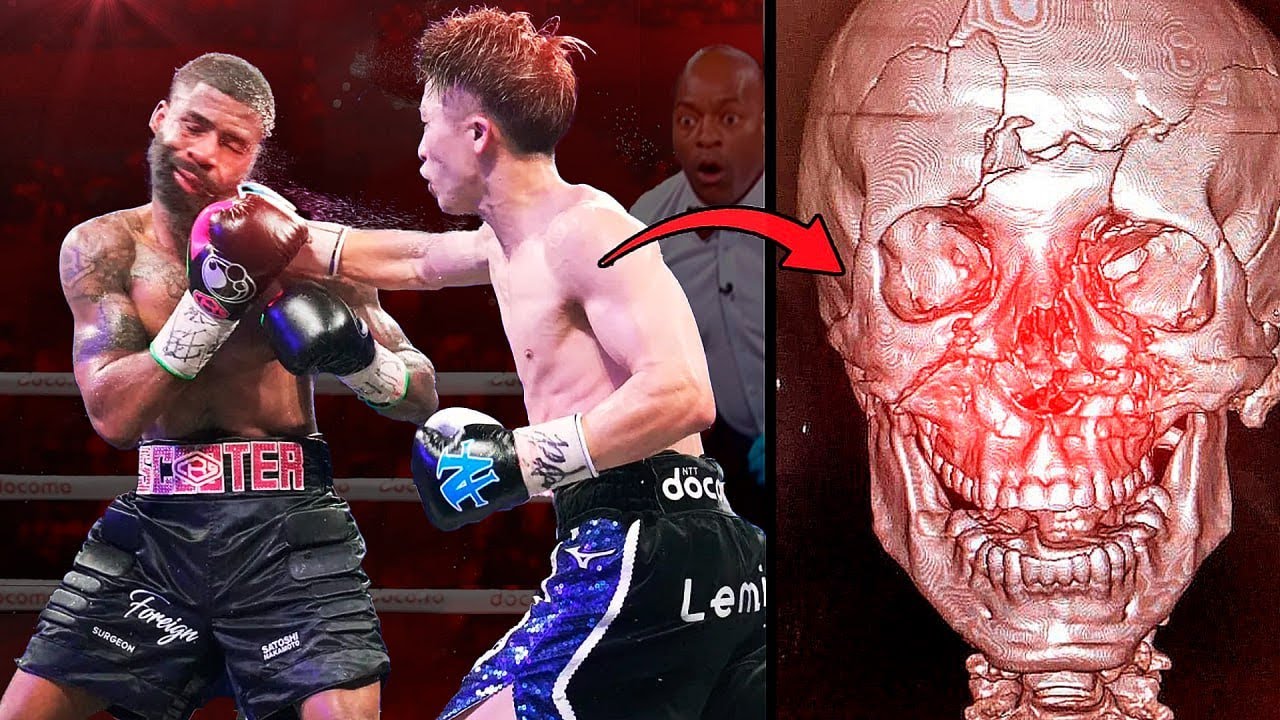 Naoya Inoue's OPPONENTS - BEFORE and AFTER Fighting