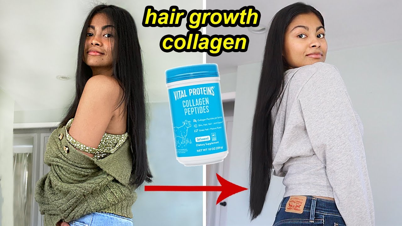 I tried HAIR GROWTH COLLAGEN for 4 months & THIS HAPPENED! | Before and after results