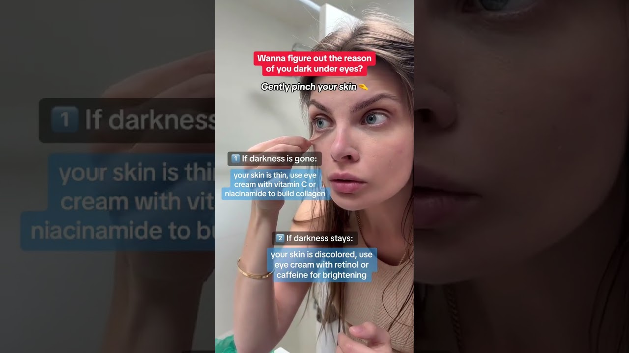 Wanna know what&rsquo;s the reason of your dark under eye circles?