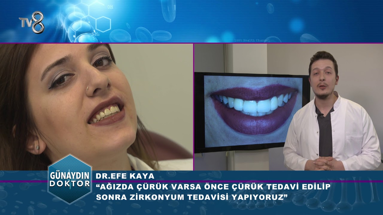 DR. EFE KAYA ZİRKONYUM TEDAVİSİ TV8  23.04.2018