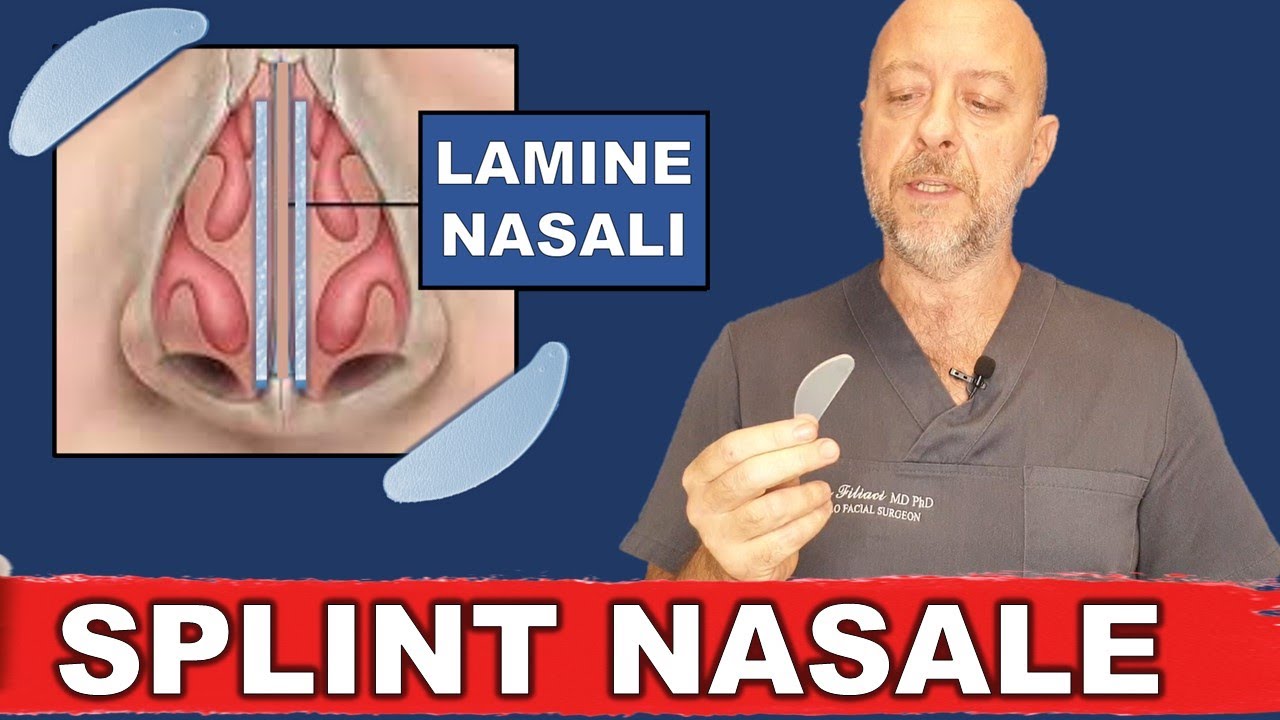 Cos'è uno splint nasale? A cosa serve la lamina nella settoplastica? Ma fa male rimuoverla?