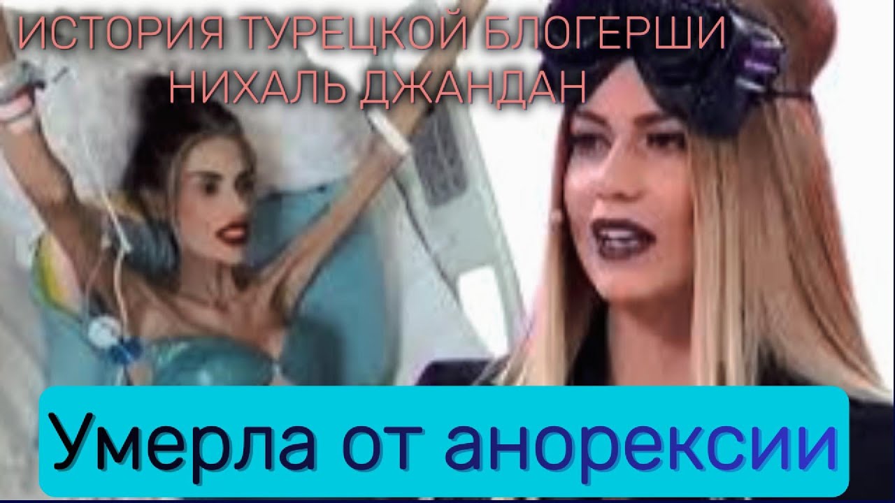 Died of Anorexia : The Story of Turkish Influencer Nihal Candan #AnorexiaAwareness#InstagramModel