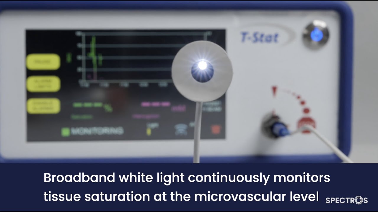 T-Stat 2.0 by SPECTROS