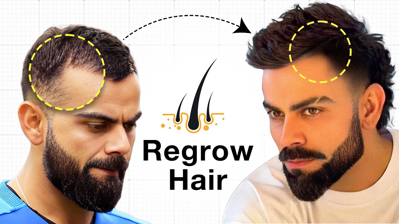 Bina Kuch Kiye Baal Kese Grow Kare?
