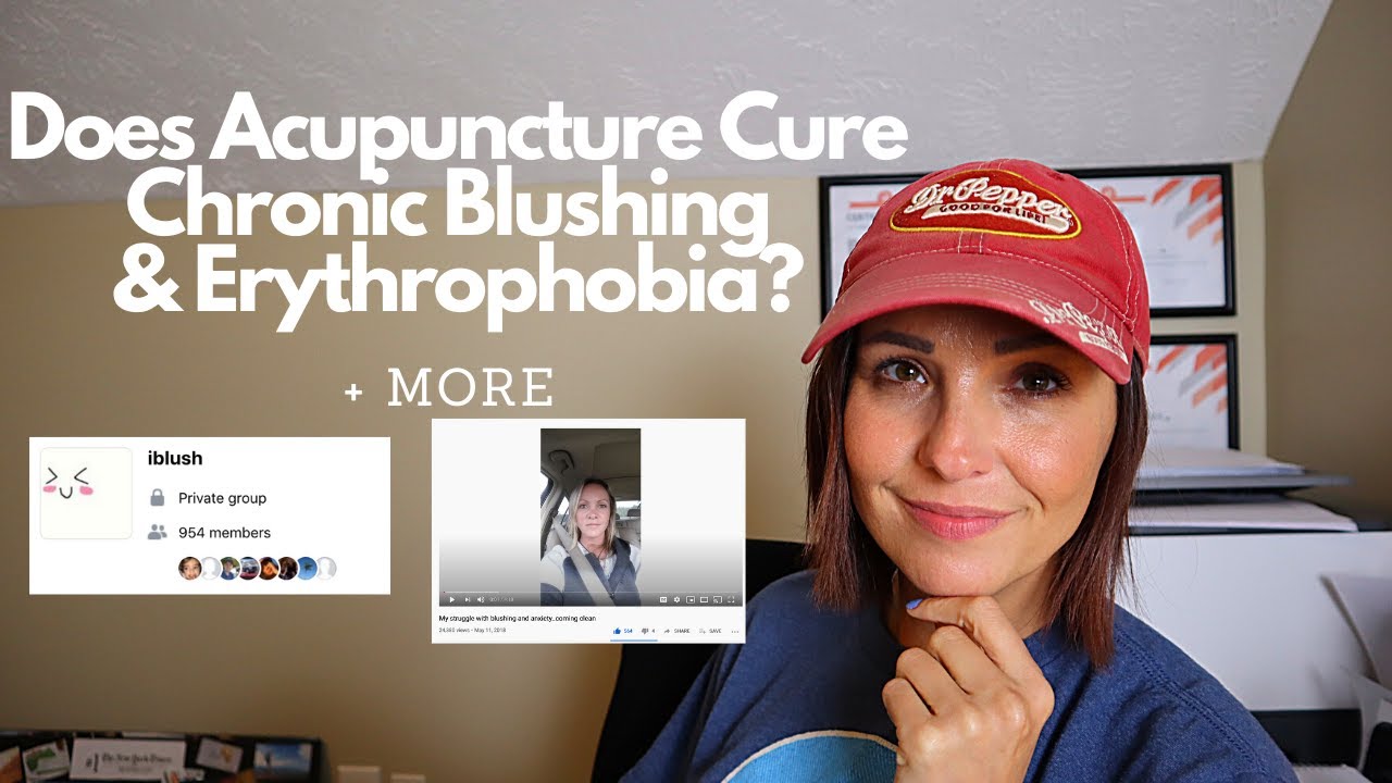 Does Acupuncture Cure Chronic Blushing & Erythrophobia? My Experience.