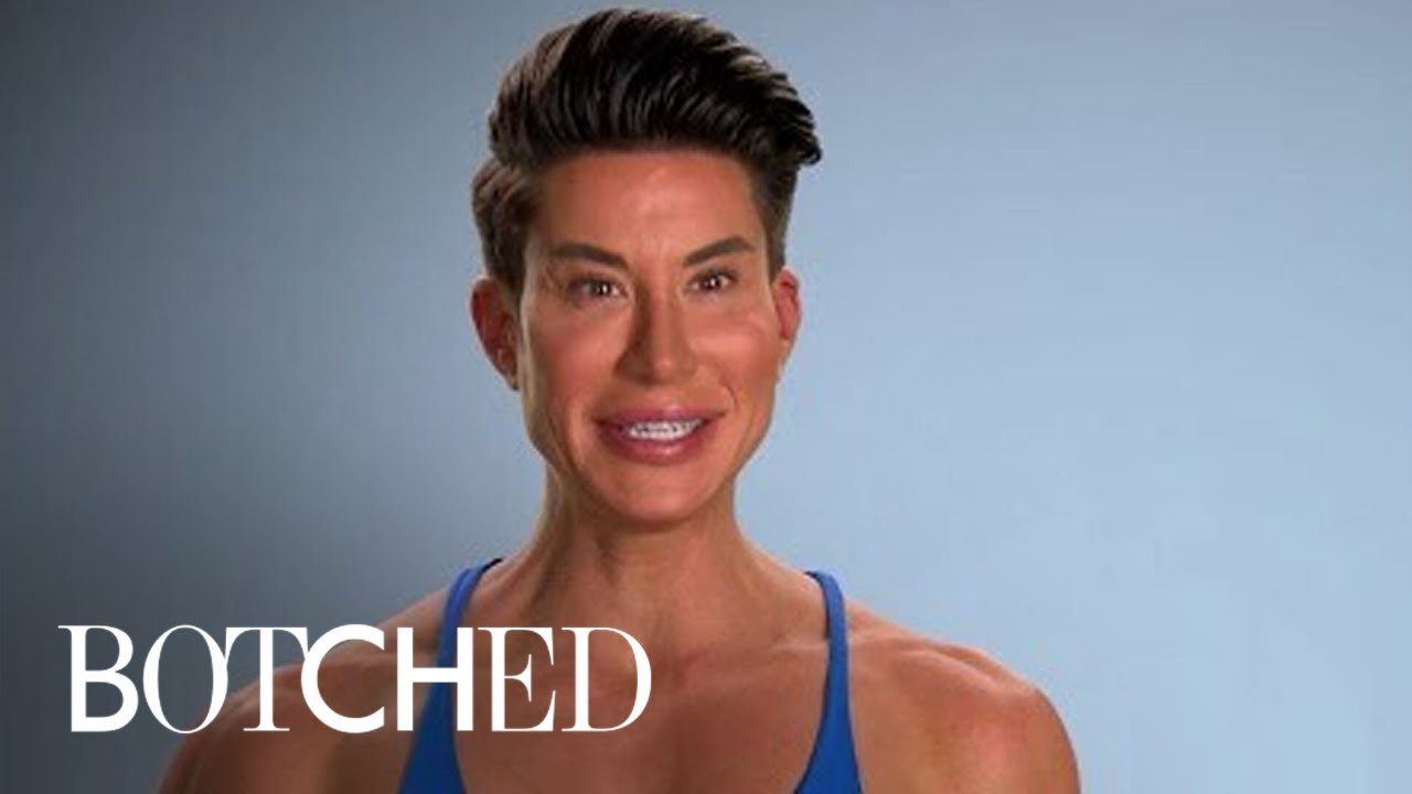 Кукла Кен ВЕРНУЛАСЬ с БОЛЬШИМ КОЛИЧЕСТВОМ имплантов | Botched | E!