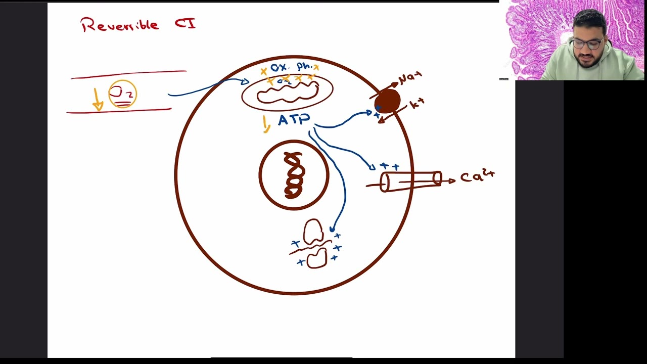 Lecture 2 | Cell Injury (PT BU)
