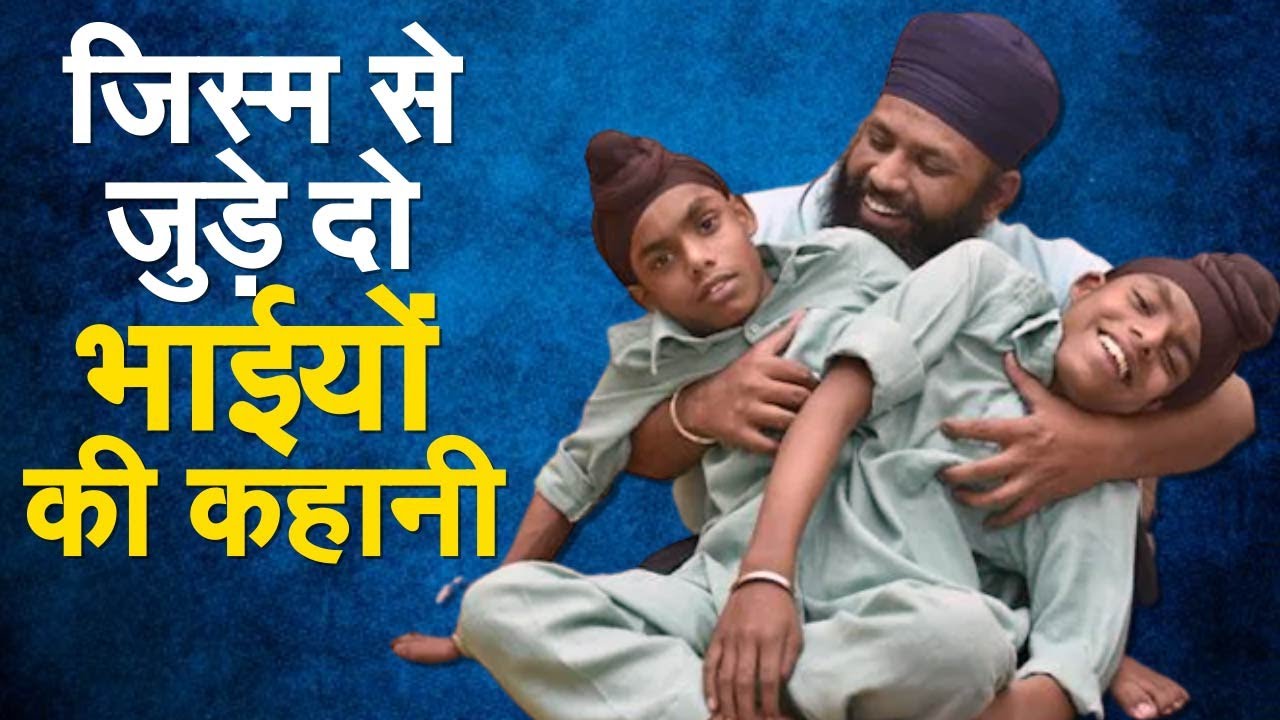 एक शरीर से जुड़े जुड़वा भाई Sohna Mohna के हौसले और हिम्मत की कहानी | Zee Original | Cojoined Twins